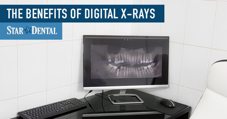 From Film to Screen: The Benefits of Digital X-Rays