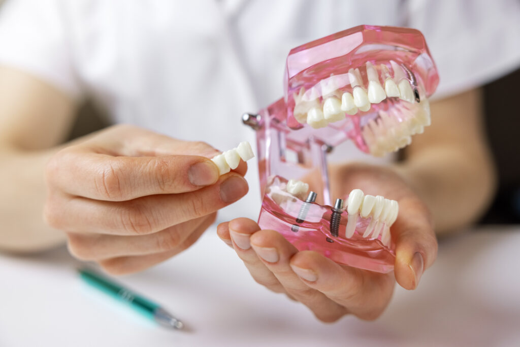 Dentist holding a replica of a full set of teeth