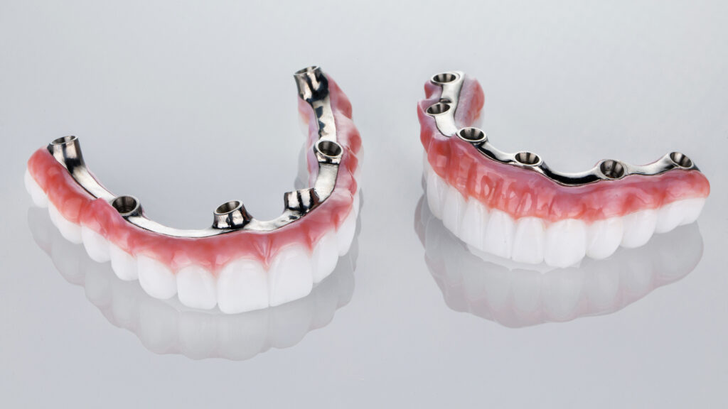 Top and bottom dental implants